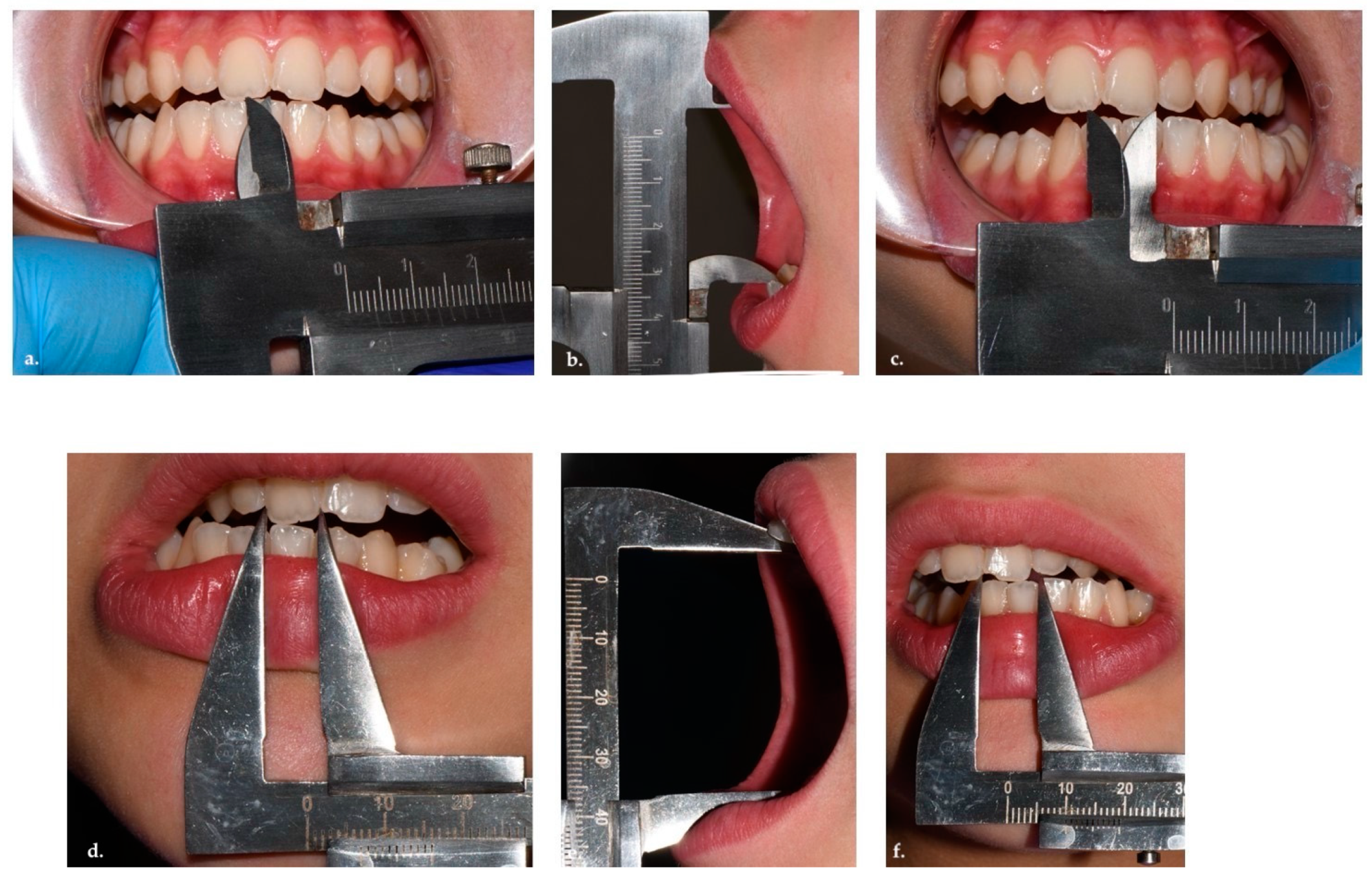 Applsci 15 04261 g003