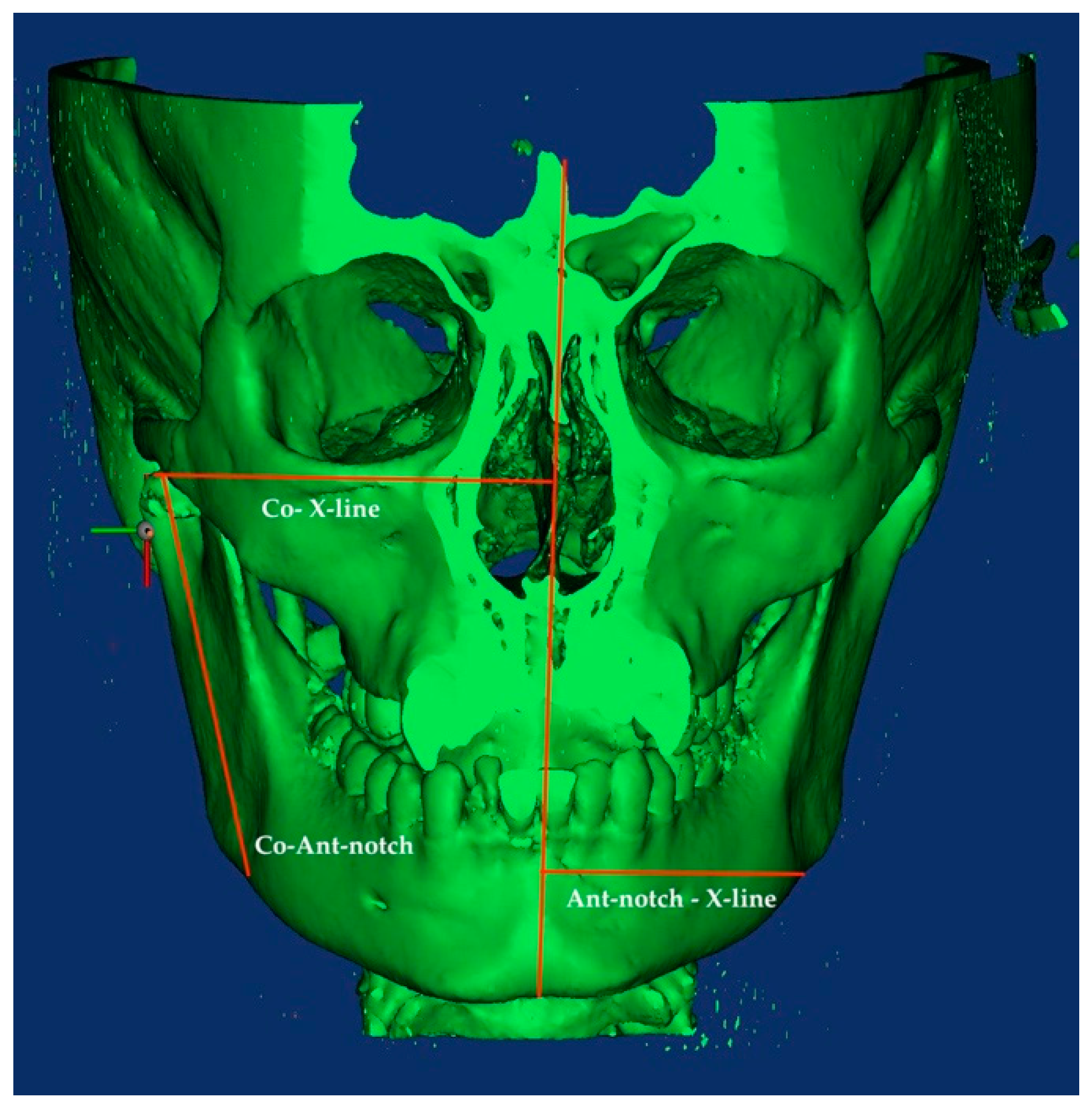 Applsci 15 04261 g004