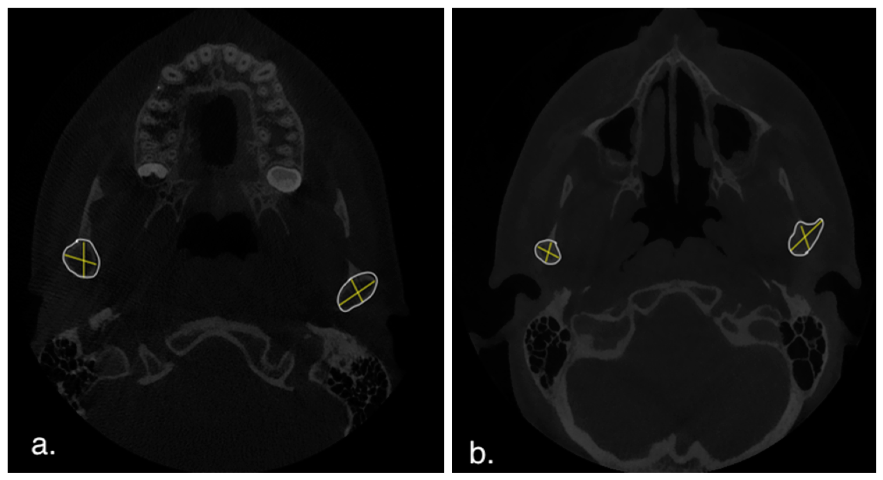 Applsci 15 04261 g005