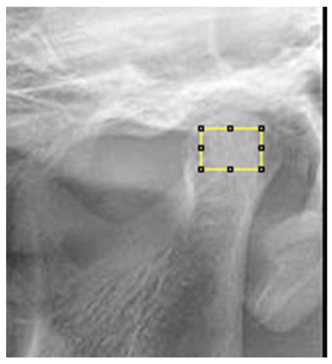 Applsci 15 04261 g006