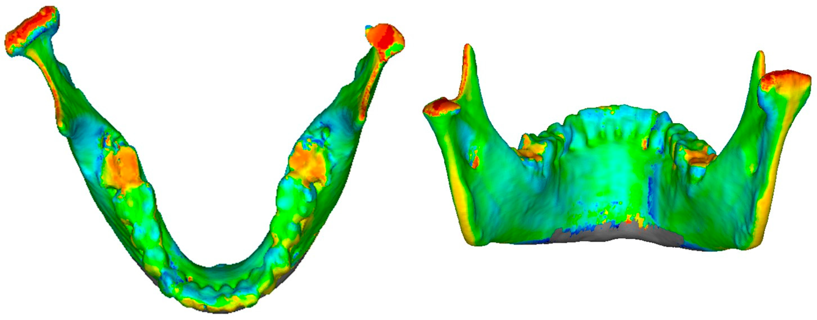 Applsci 15 04261 g011