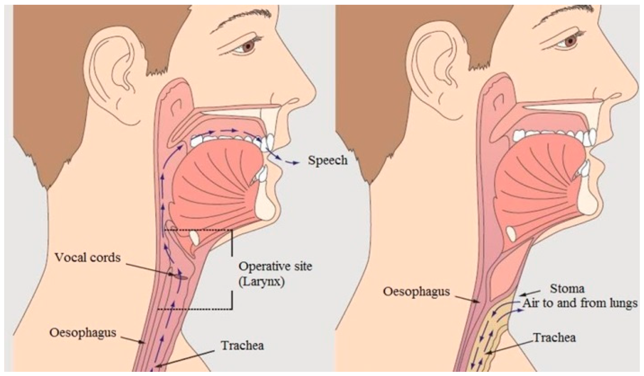 Applsci 15 04402 g001