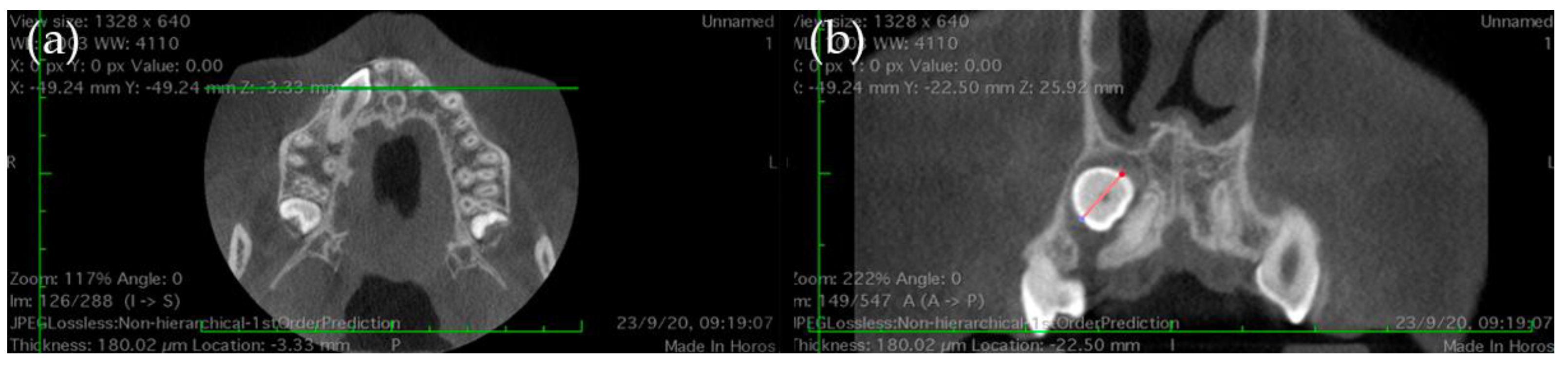 Applsci 15 04805 g001