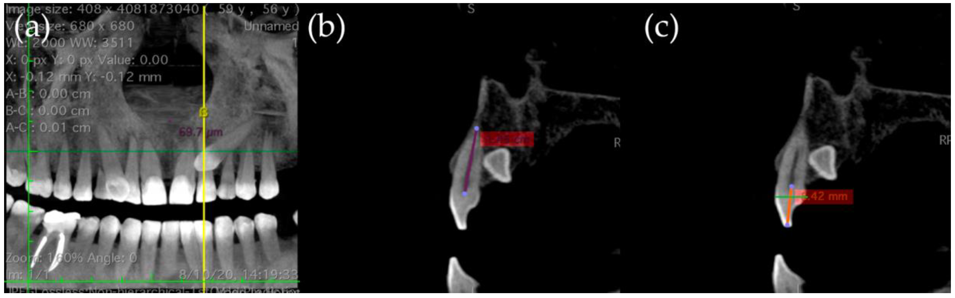 Applsci 15 04805 g003