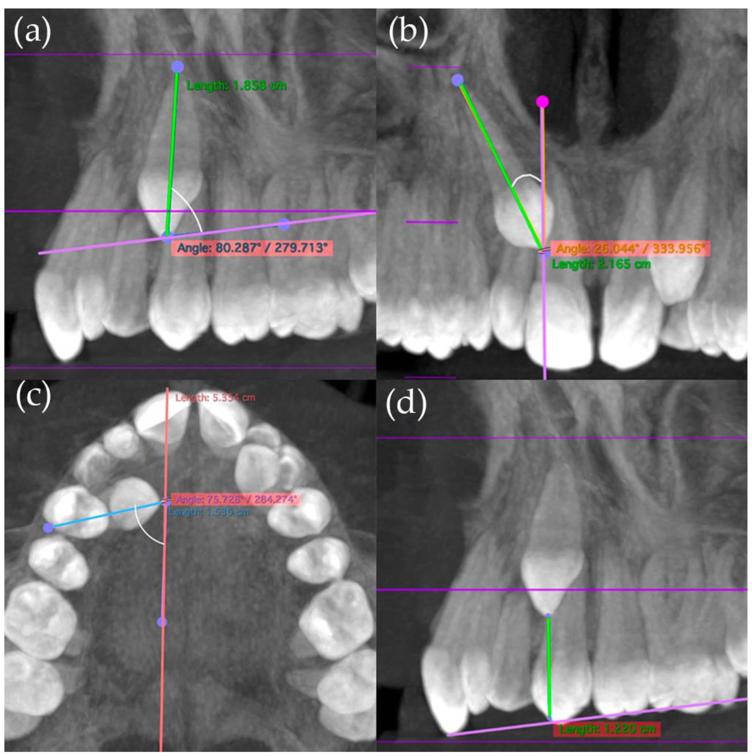 Applsci 15 04805 g005