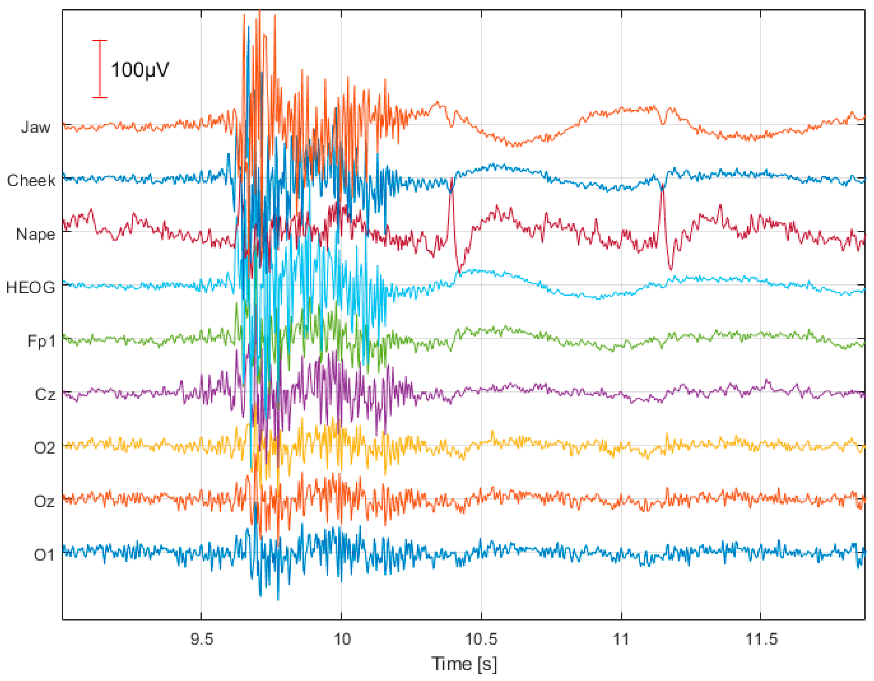 Applsci 15 04953 g002