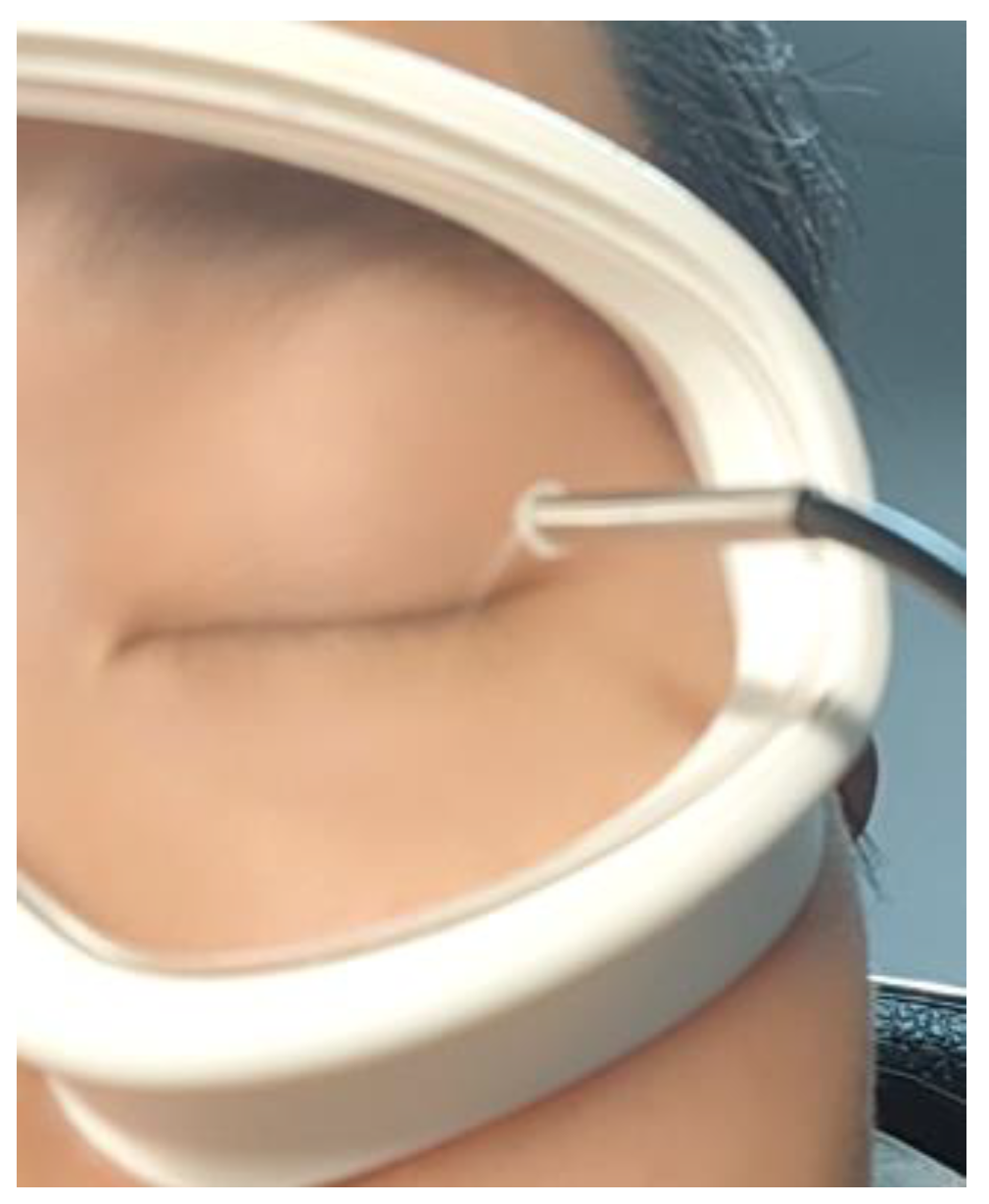 Applsci 15 04981 g004