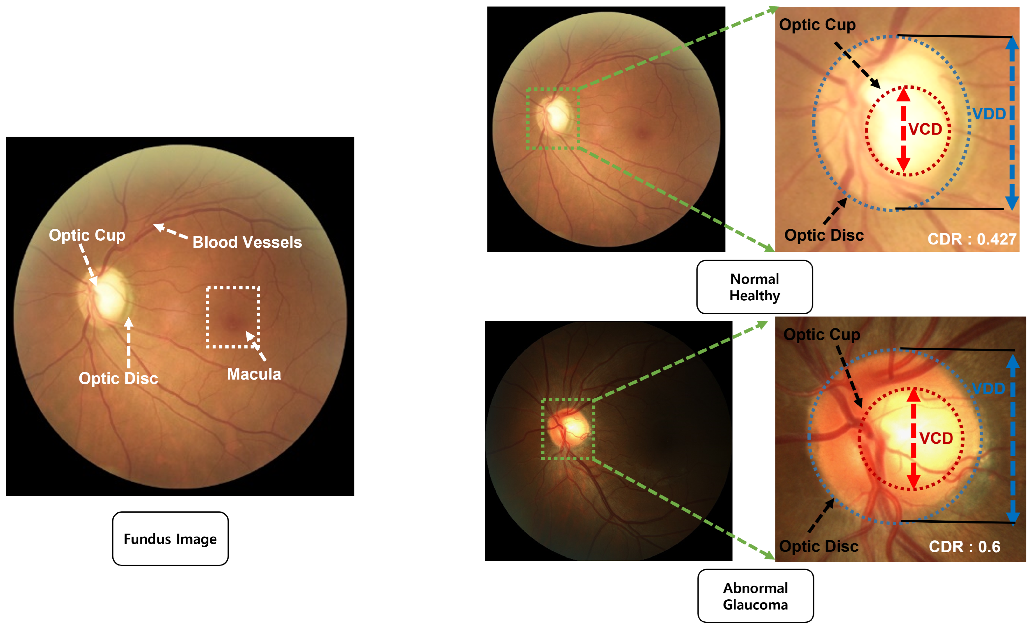 Applsci 15 05165 g001