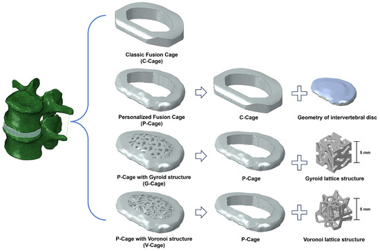 Biomechanical Optimization of Lumbar Fusion Cages with a
