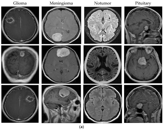 A Novel Hybrid Deep Learning Model Enhanced with Explainable AI