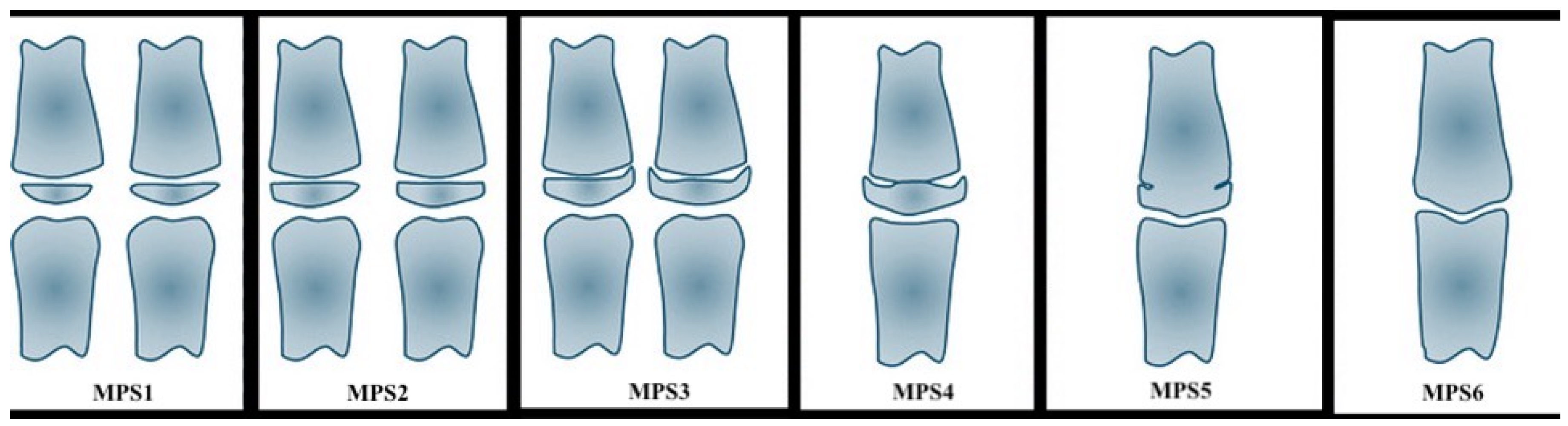 Applsci 15 05593 g001