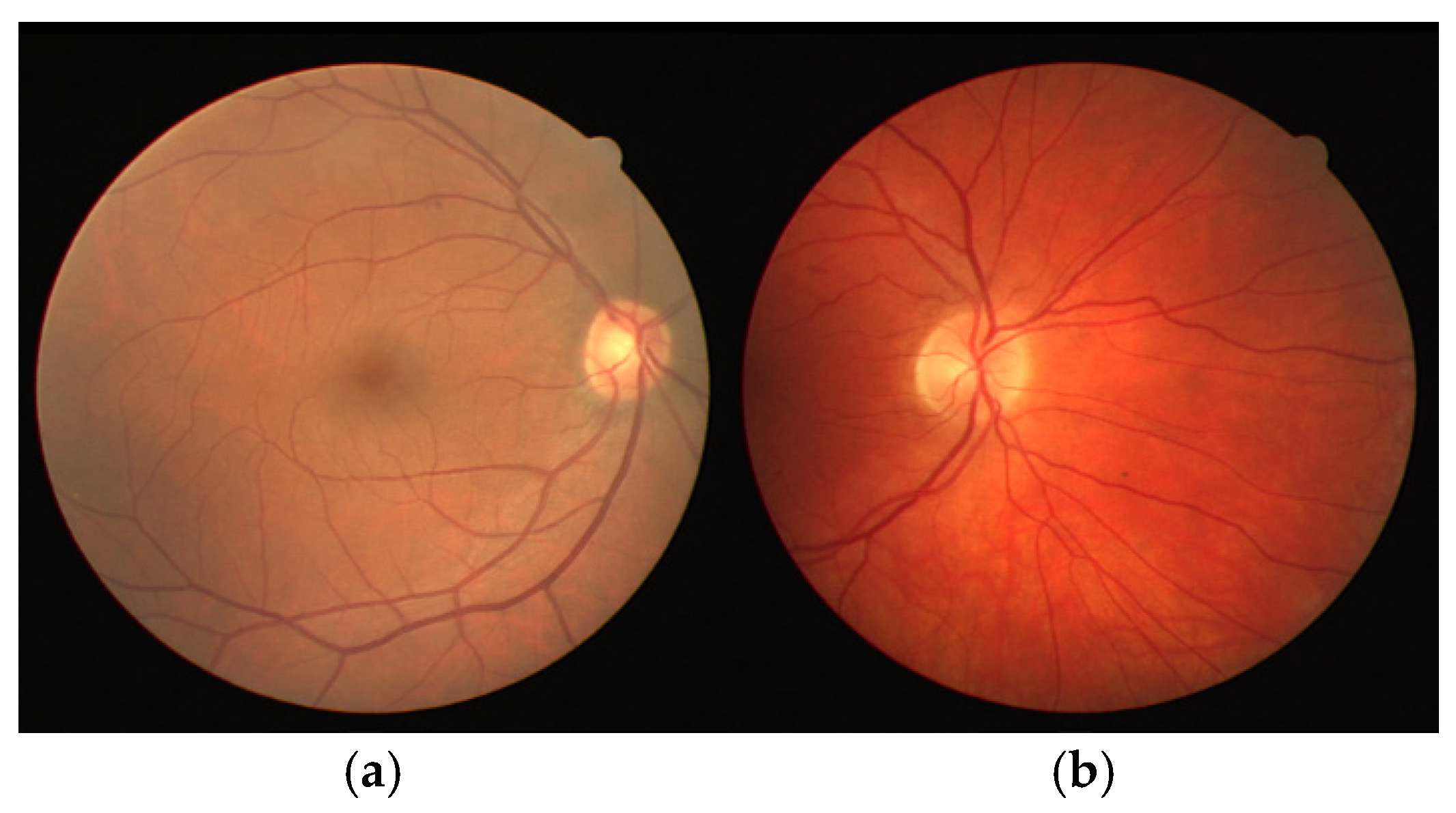 Applsci 15 05693 g001