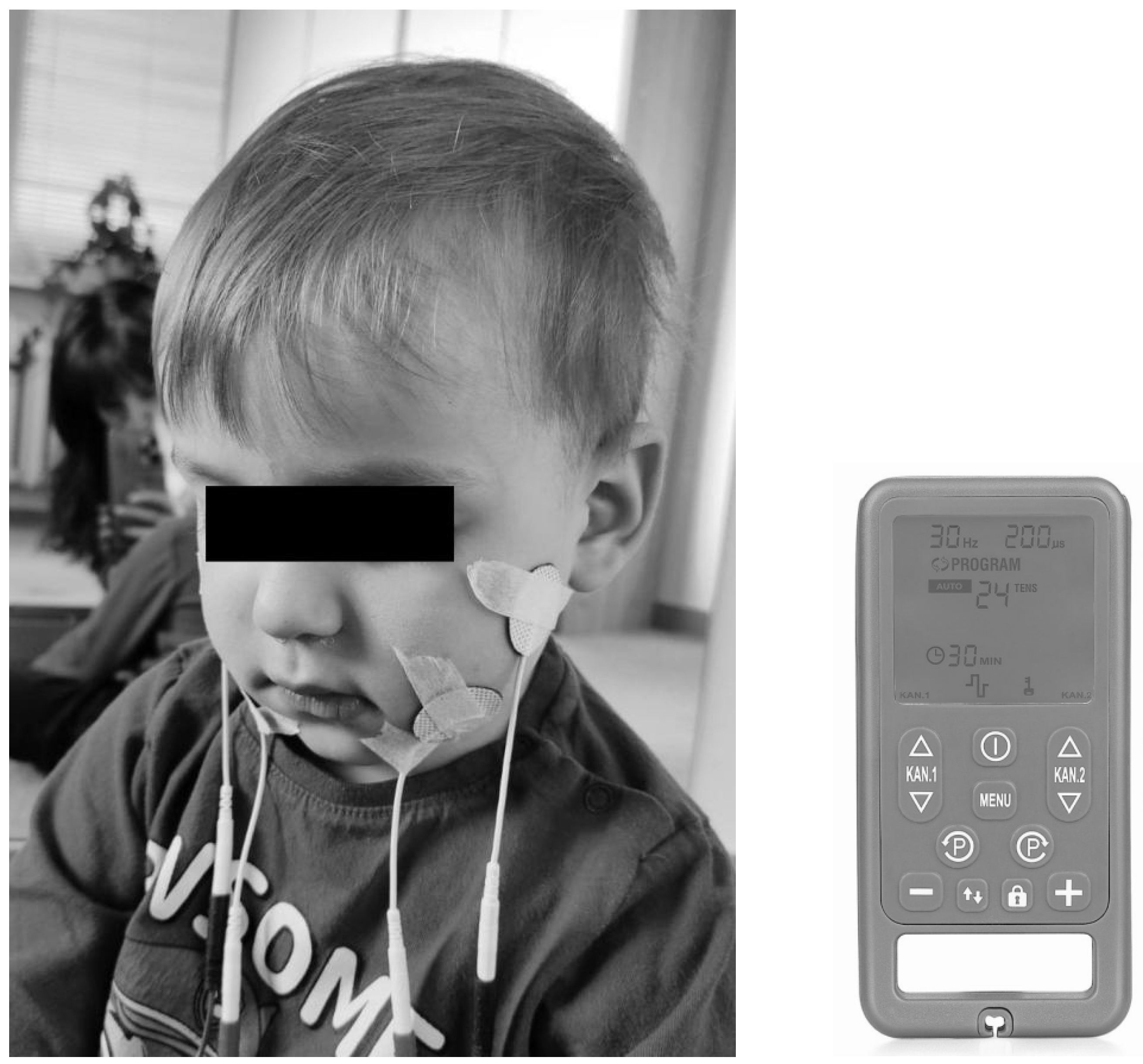 Applsci 15 05727 g003