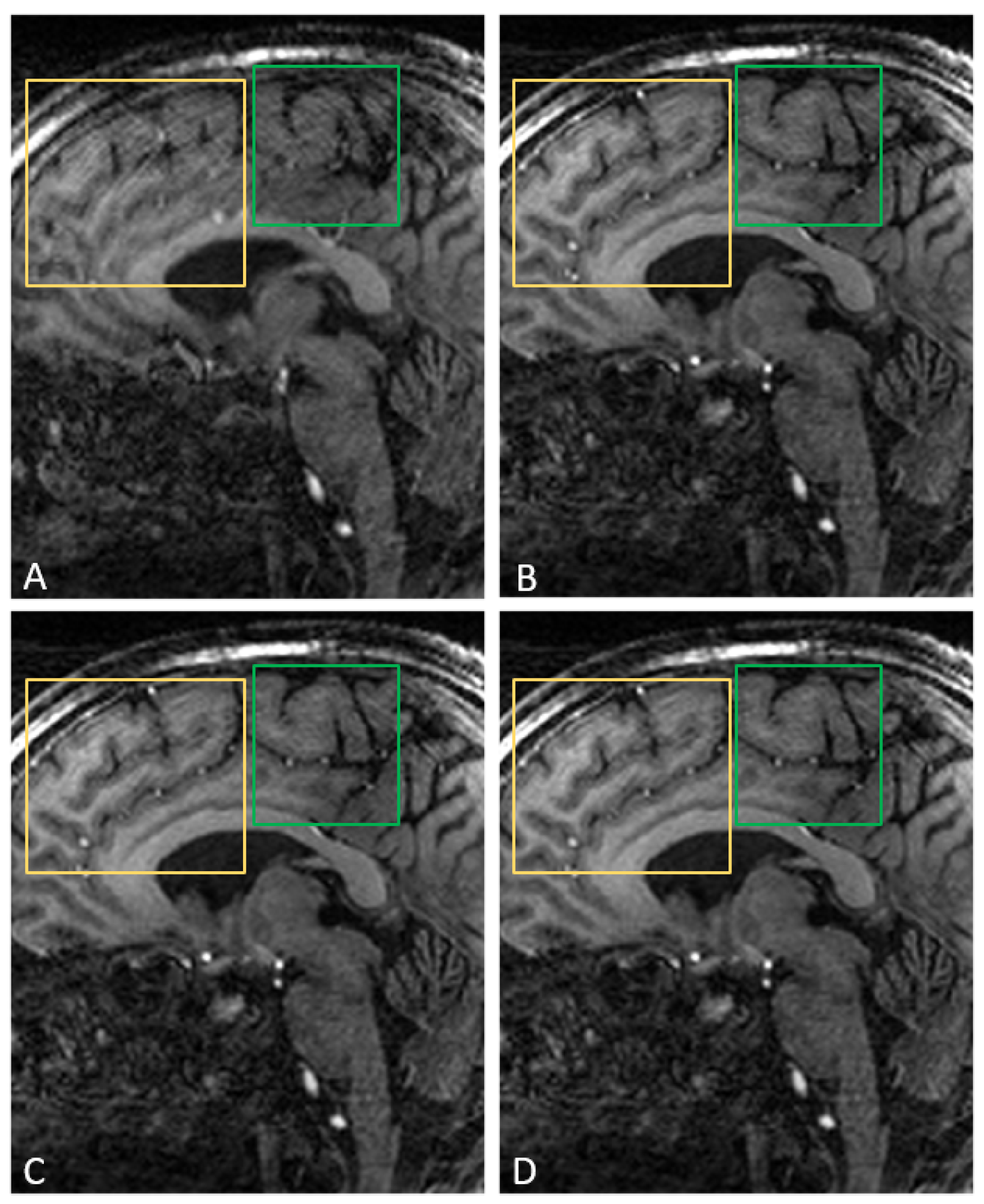 Applsci 15 05840 g005