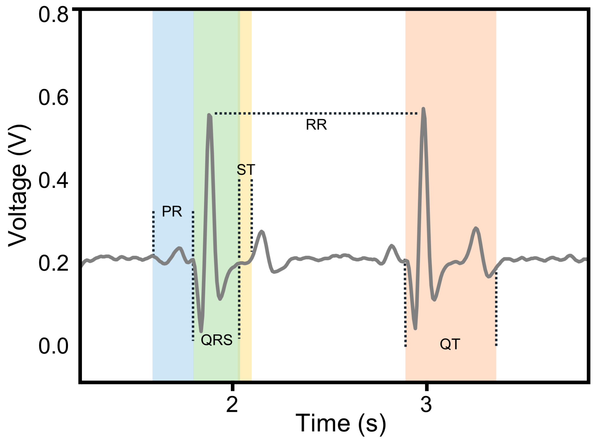 Applsci 15 05920 g005