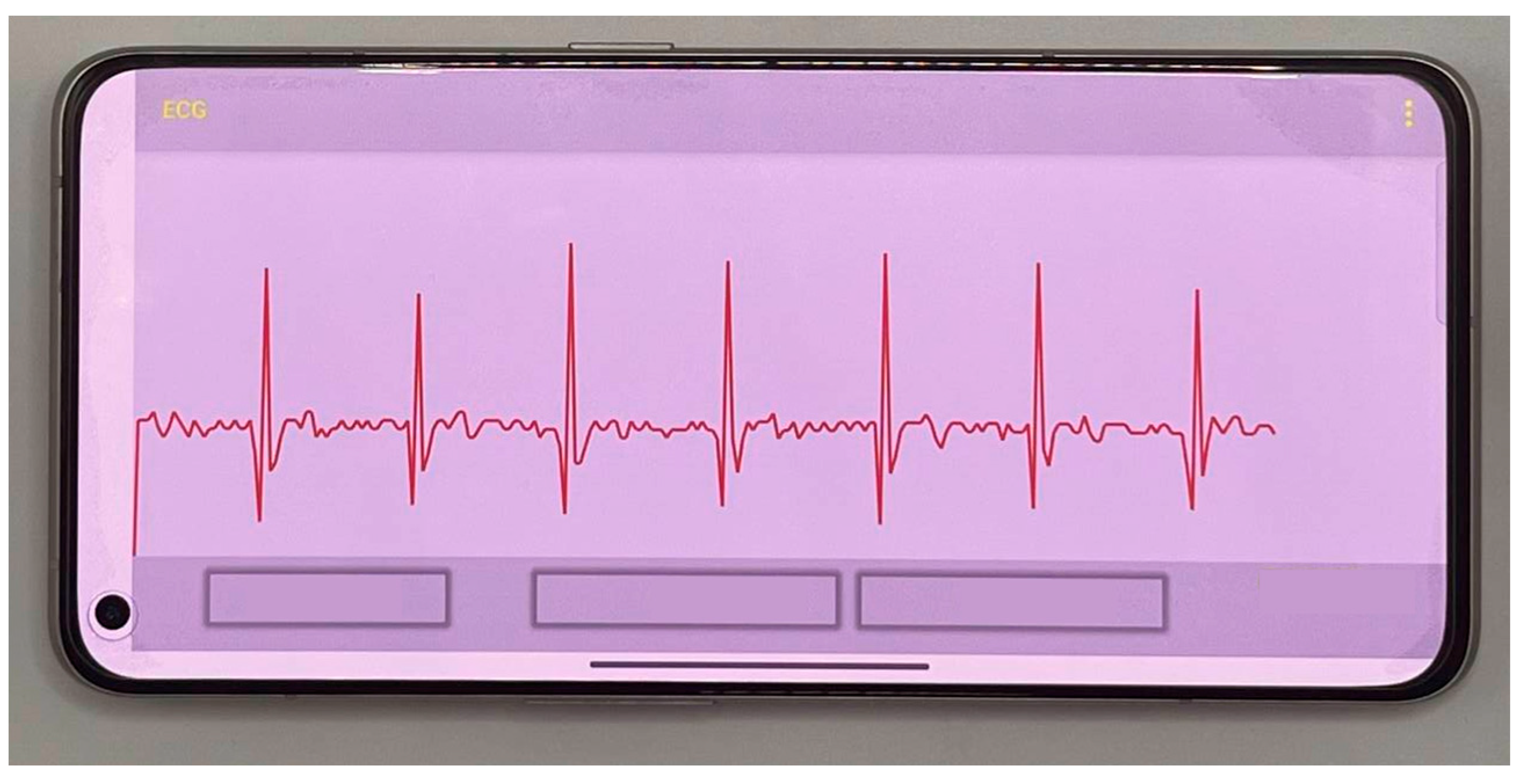 Applsci 15 05920 g013