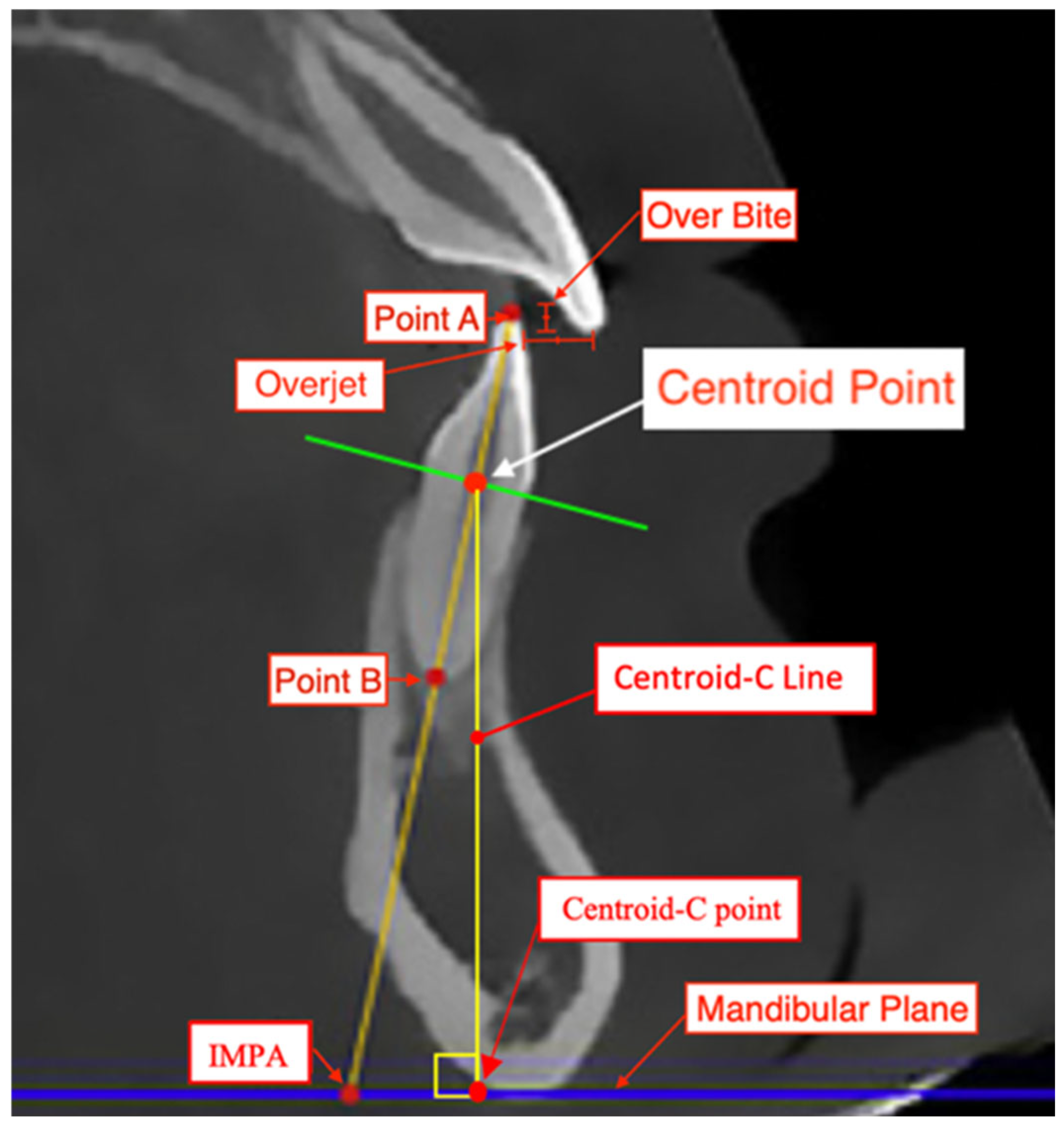 Applsci 15 05954 g001