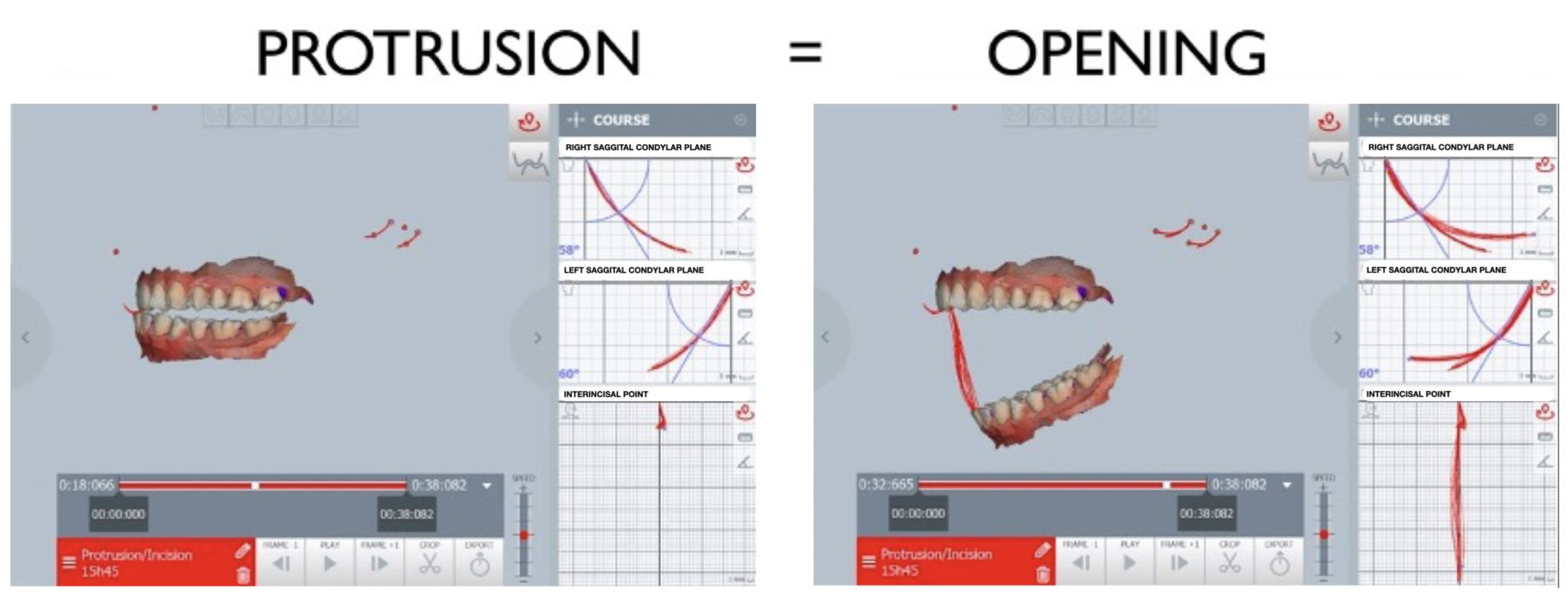 Applsci 15 05993 g003