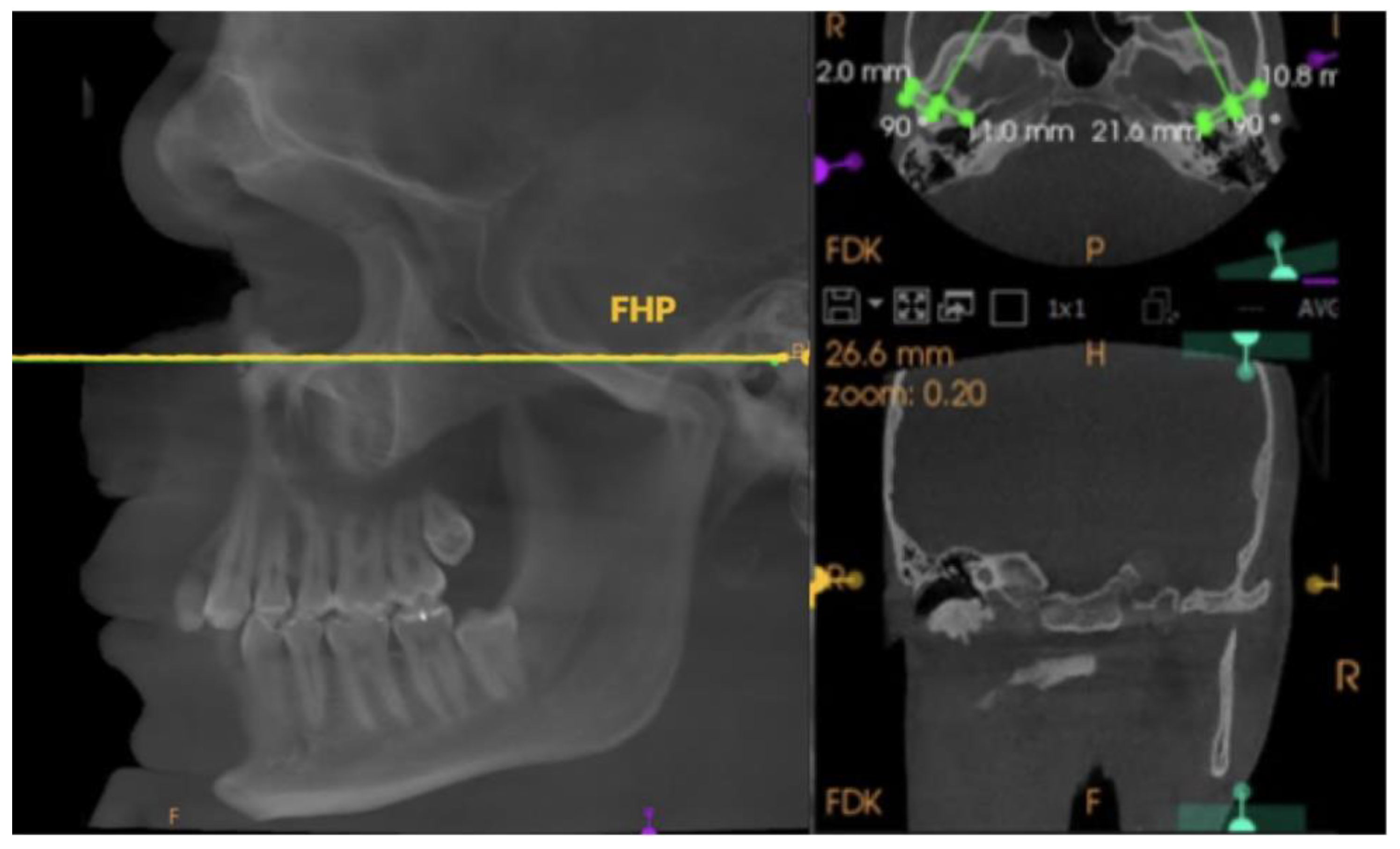 Applsci 15 05993 g004