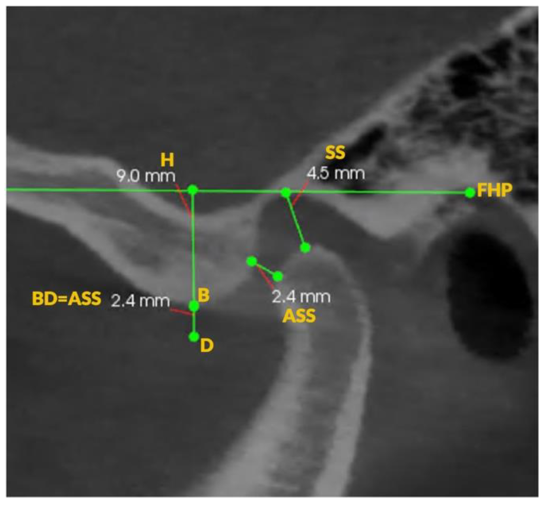 Applsci 15 05993 g006
