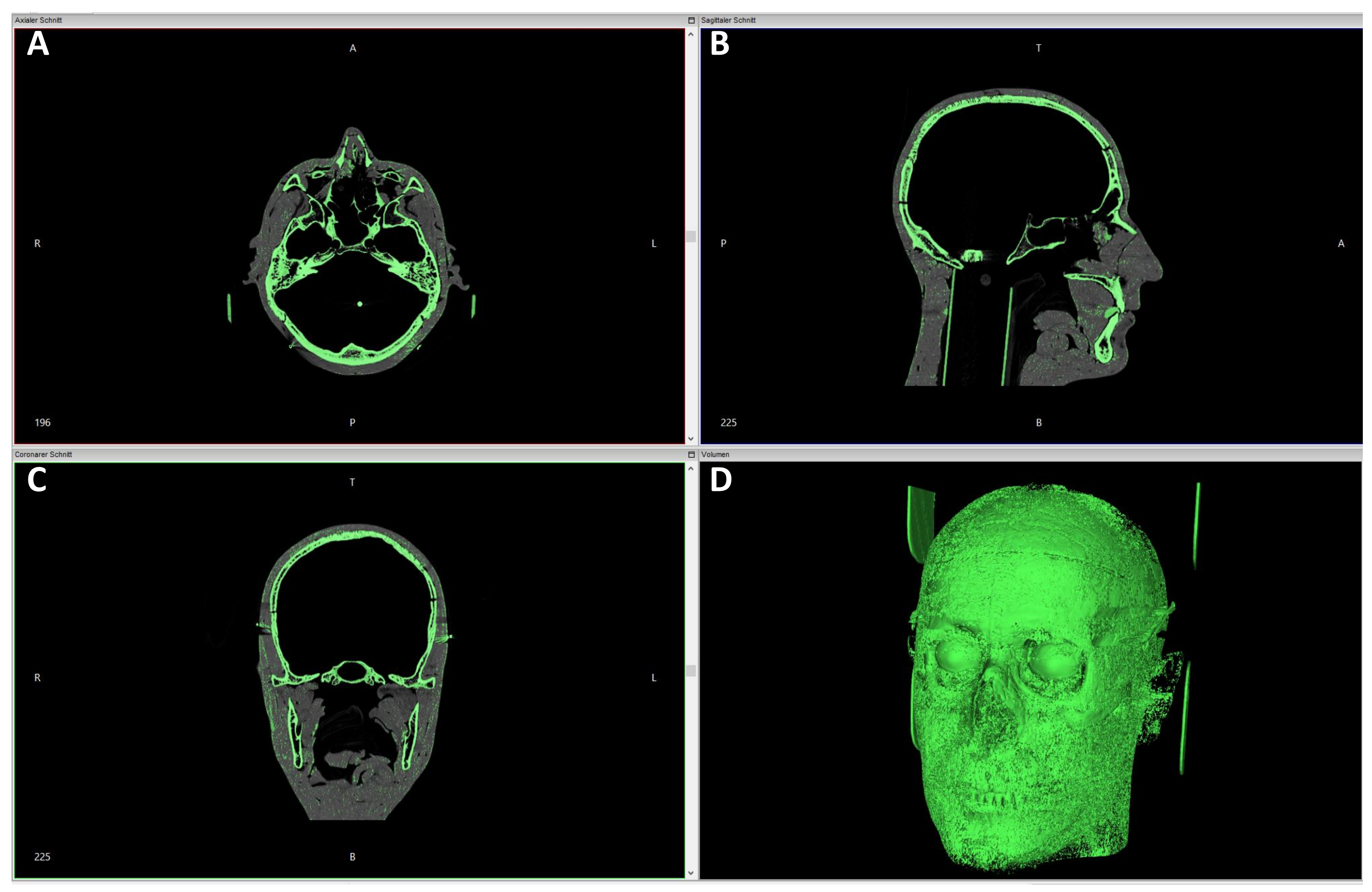 Applsci 15 06086 g003