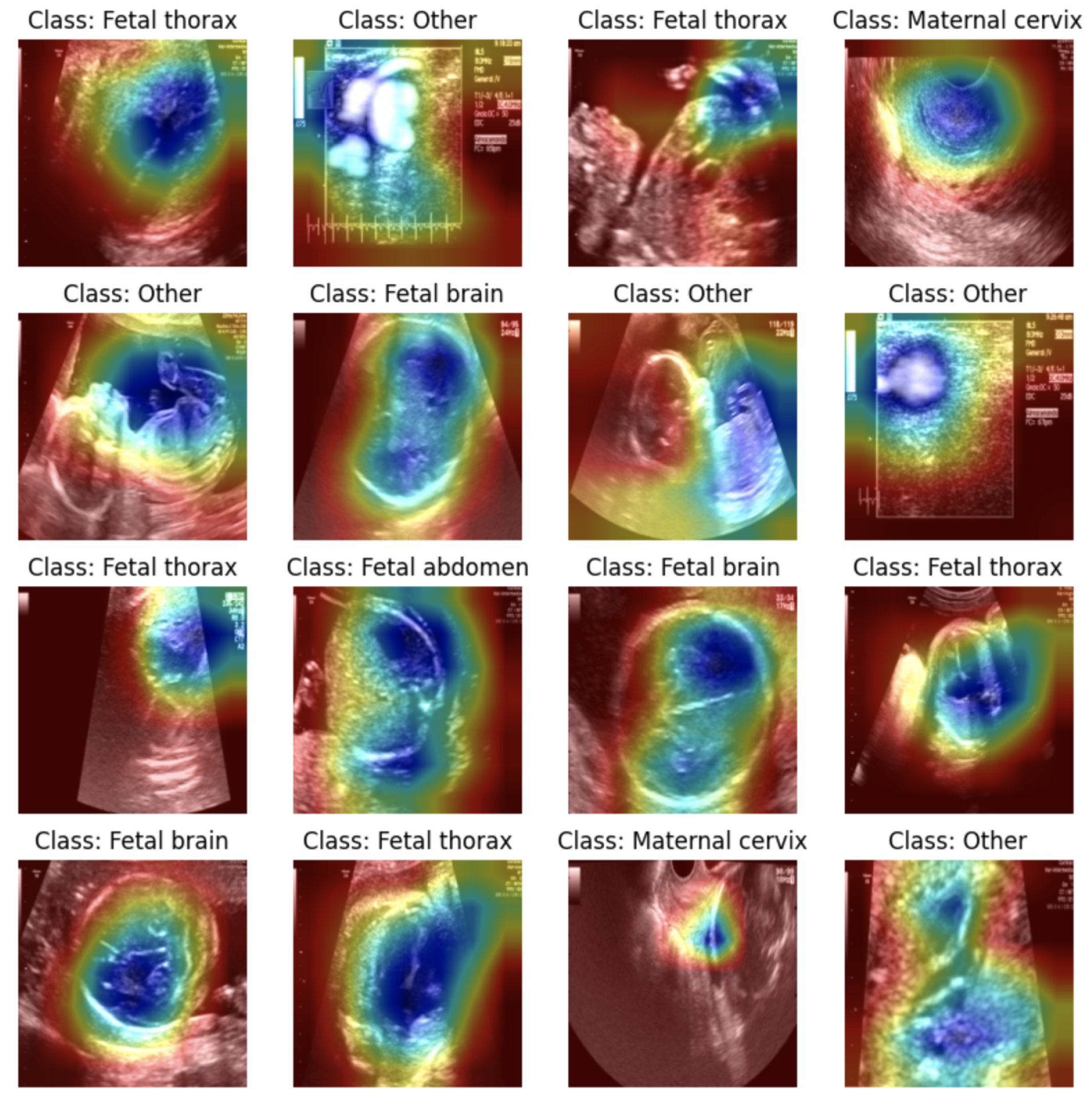 Applsci 15 06152 g025