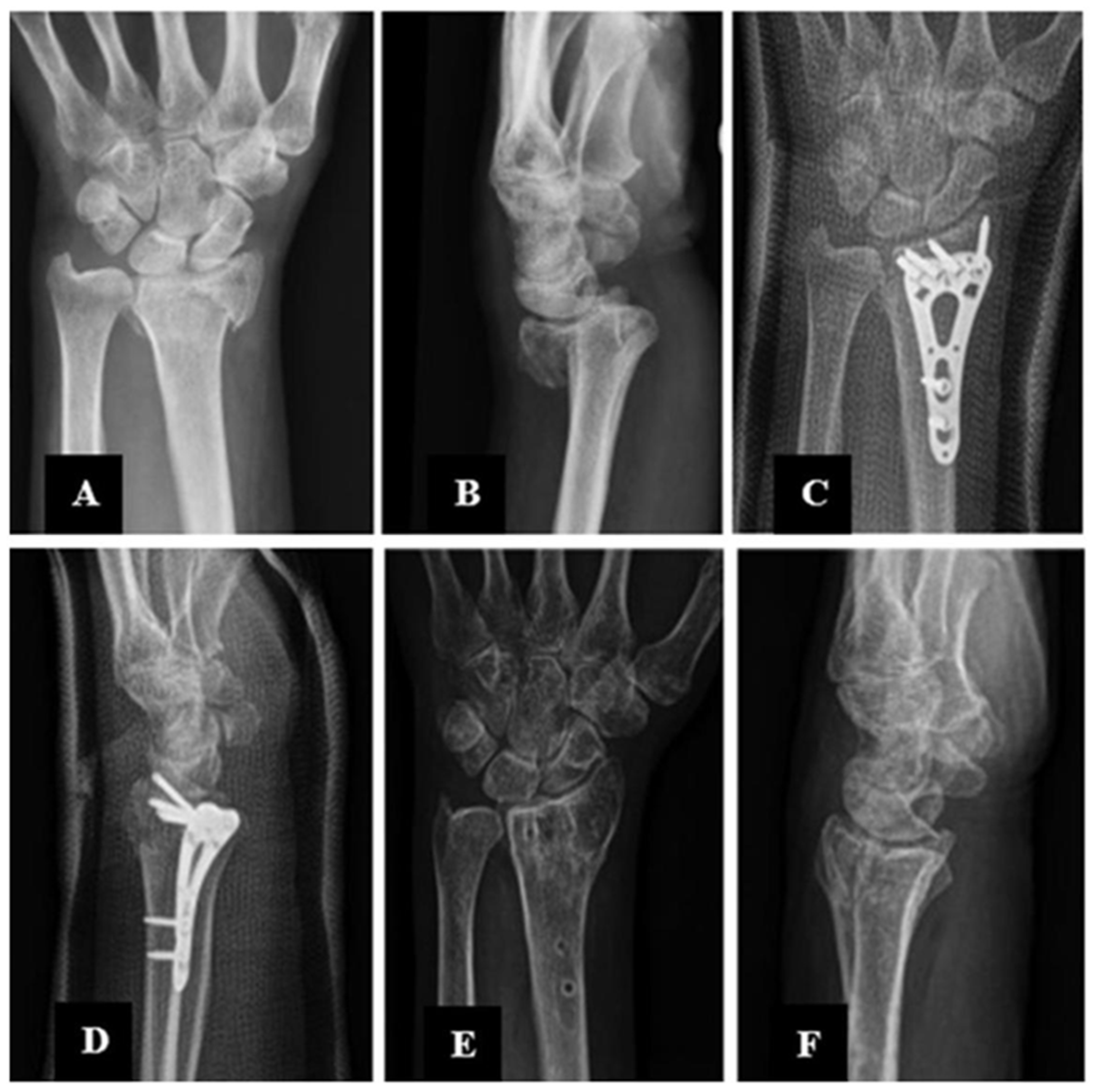 Applsci 15 06235 g005