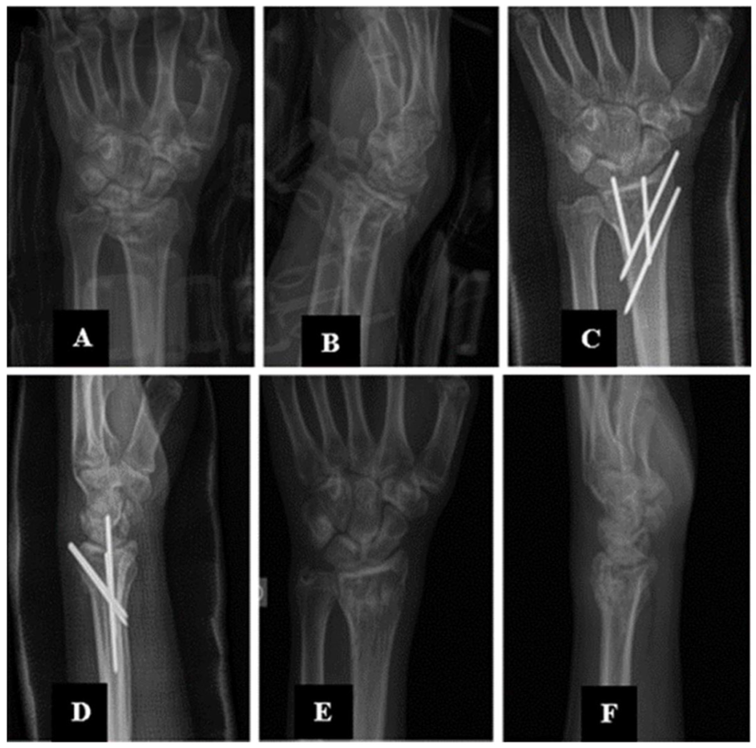 Applsci 15 06235 g006