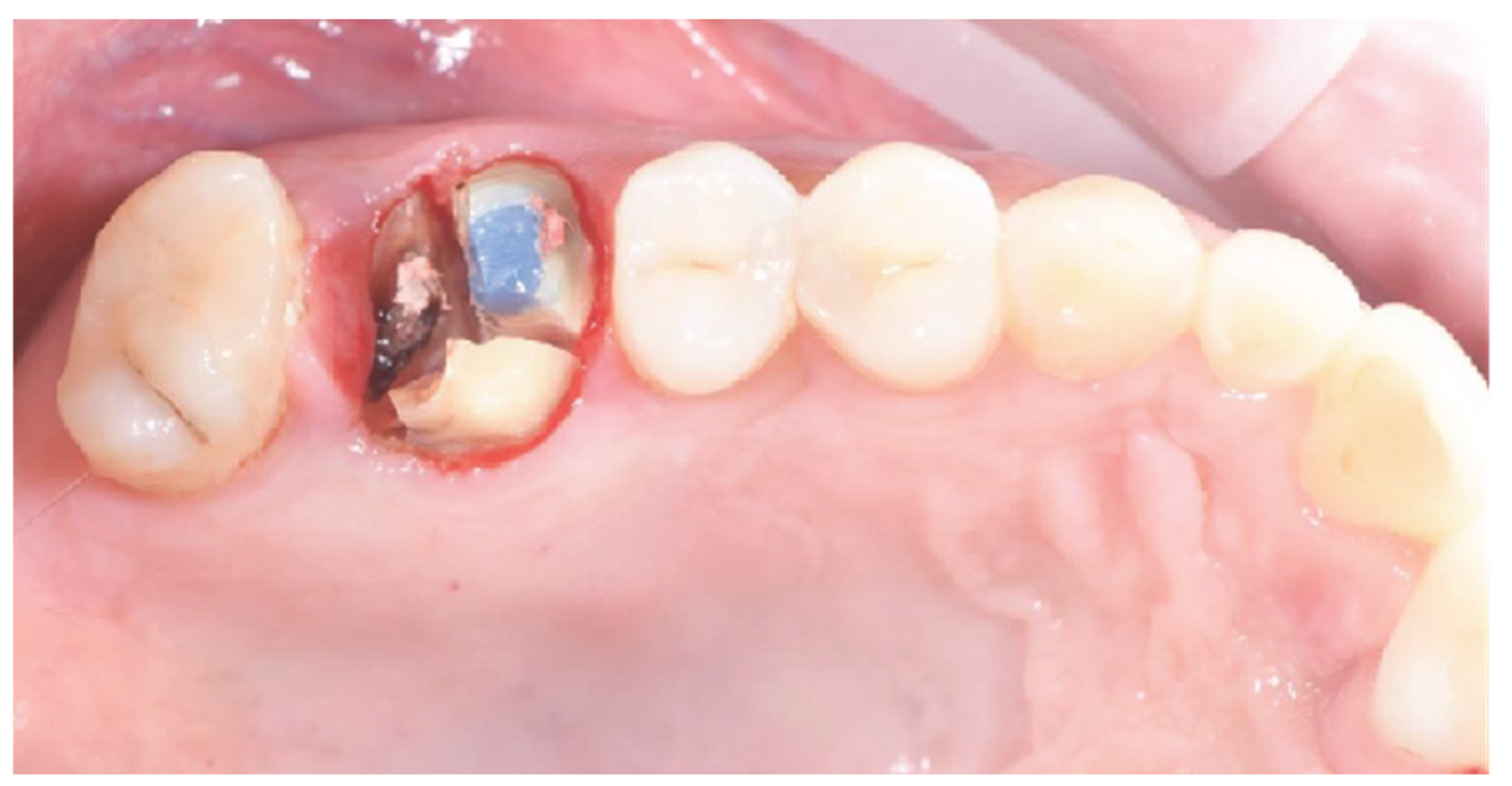 Applsci 15 06344 g001