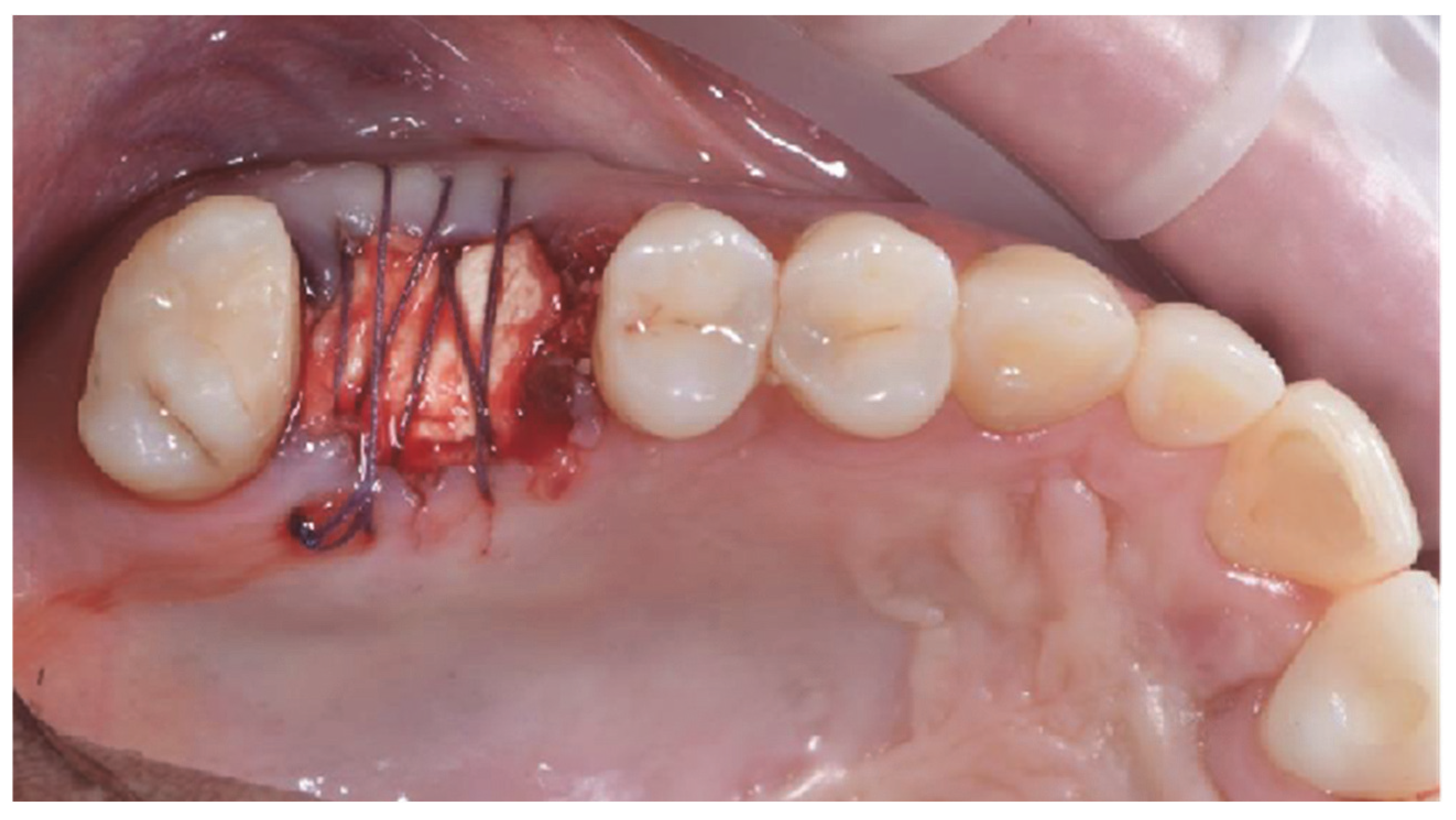 Applsci 15 06344 g004