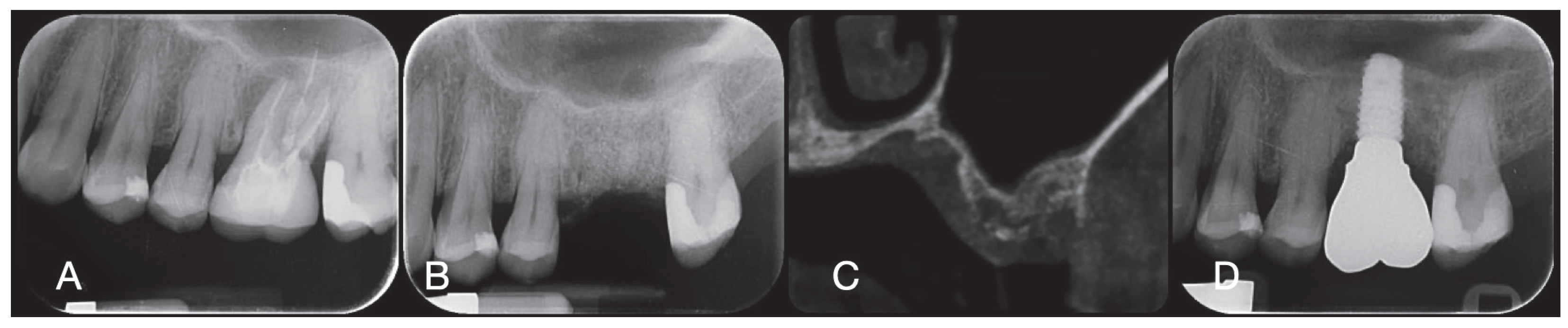 Applsci 15 06344 g005