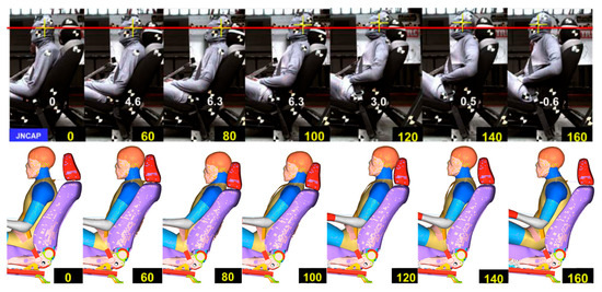 Occupant Kinematic and Injury Responses in Zero-Gravity Seat