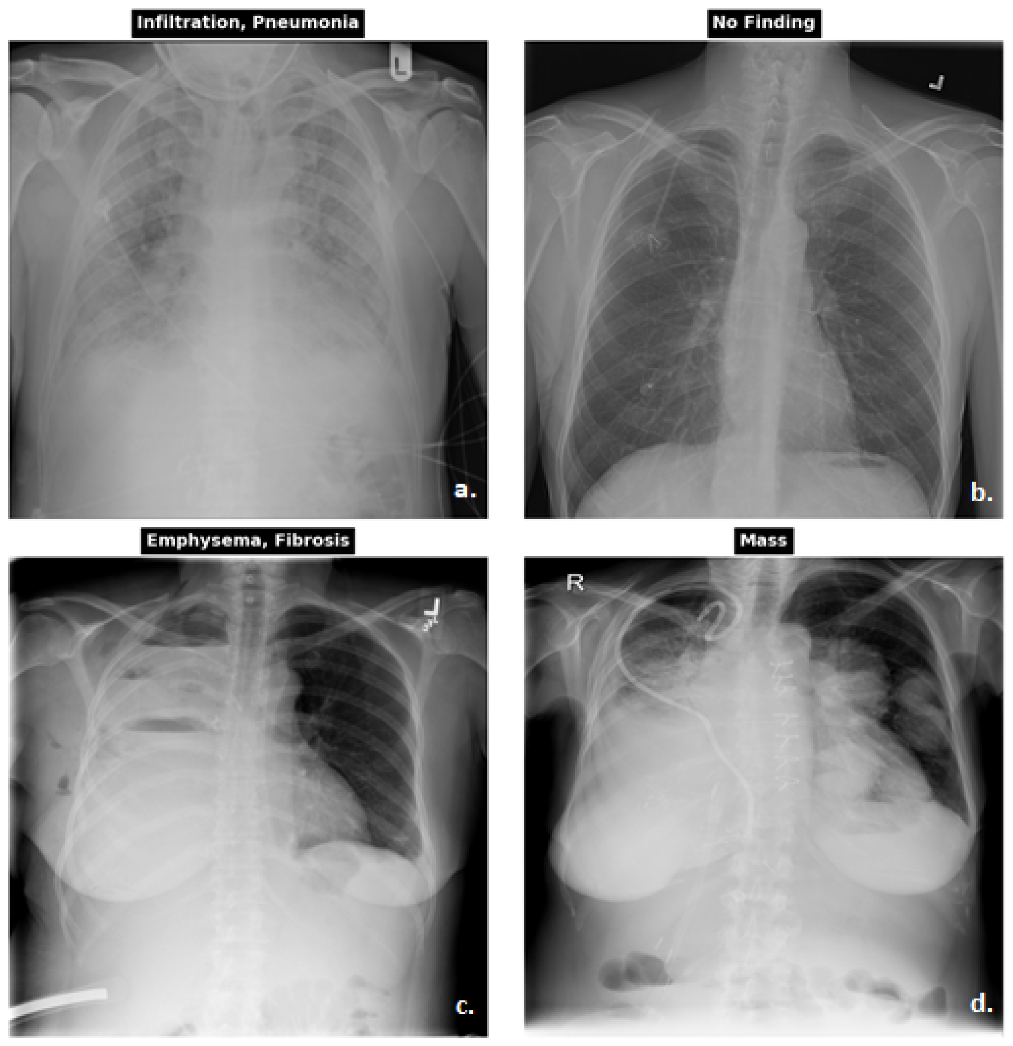 Applsci 15 06487 g001