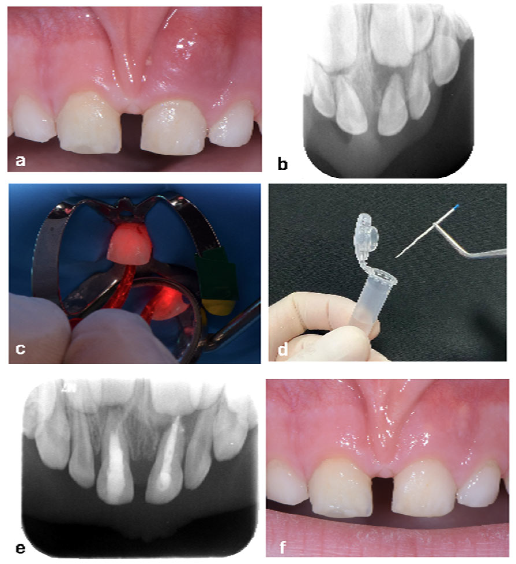 Applsci 15 06491 g002 Applsci 15 06491 g002