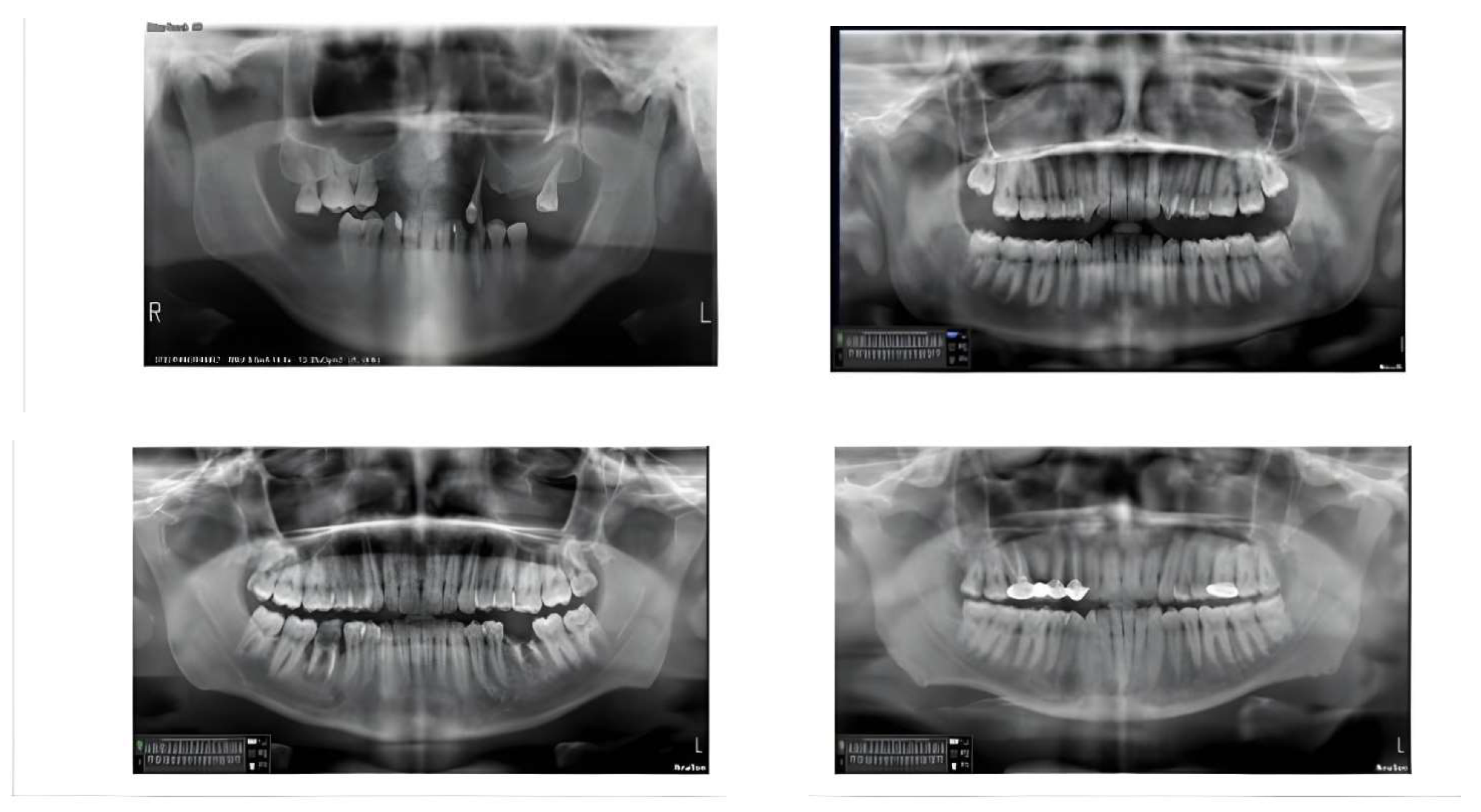 Applsci 15 06832 g004