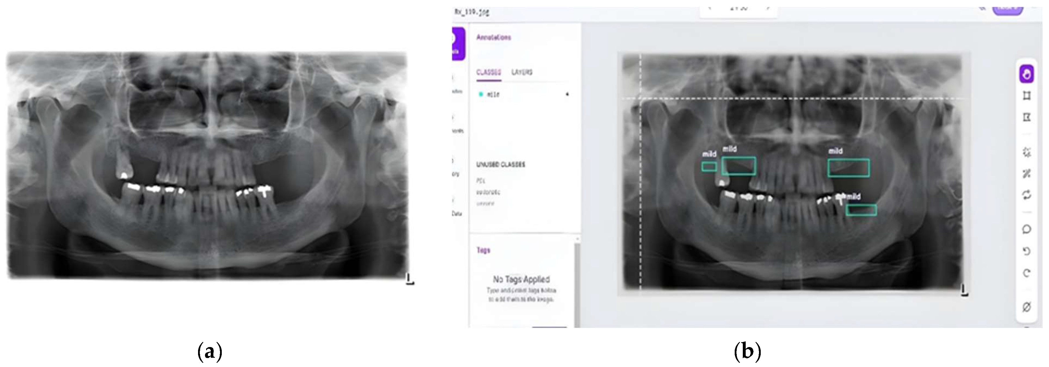 Applsci 15 06832 g006