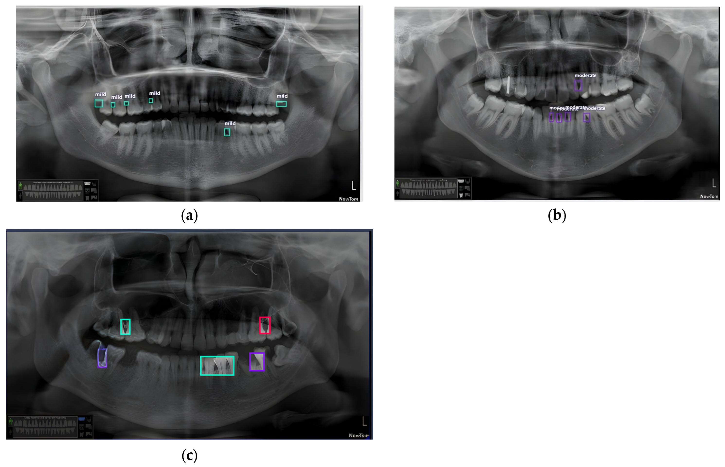Applsci 15 06832 g011
