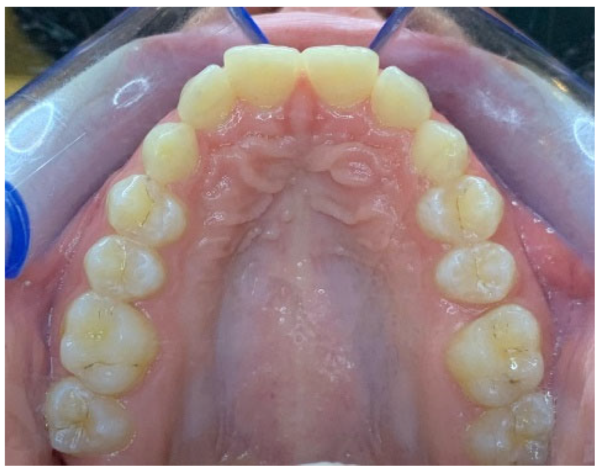 Applsci 15 06837 g003