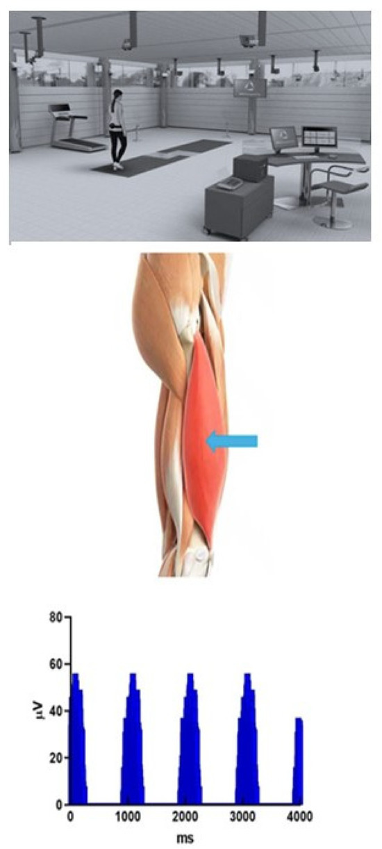 An EMG-to-Force Processing Method for Estimating In Vivo Knee Muscle ...
