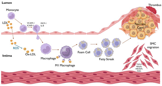 From Dysbiosis to Cardiovascular Disease: The Impact of Gut