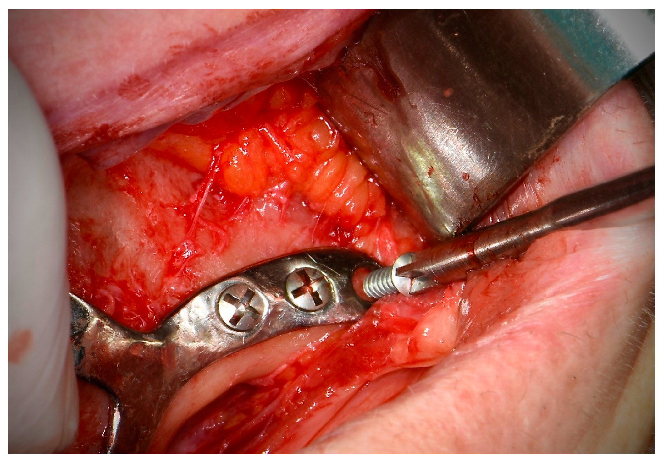 Applsci 15 07633 g004