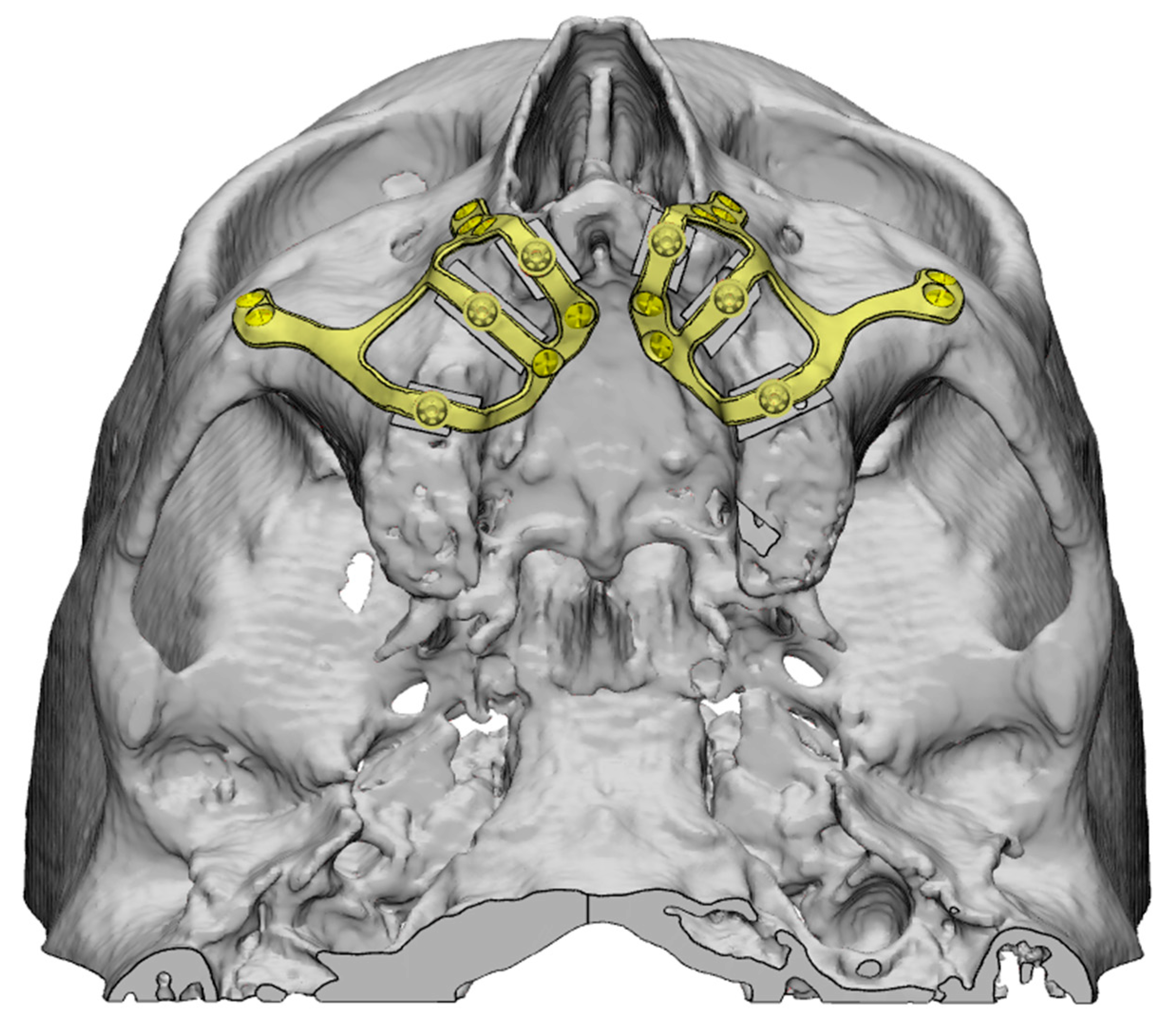 Applsci 15 07633 g006