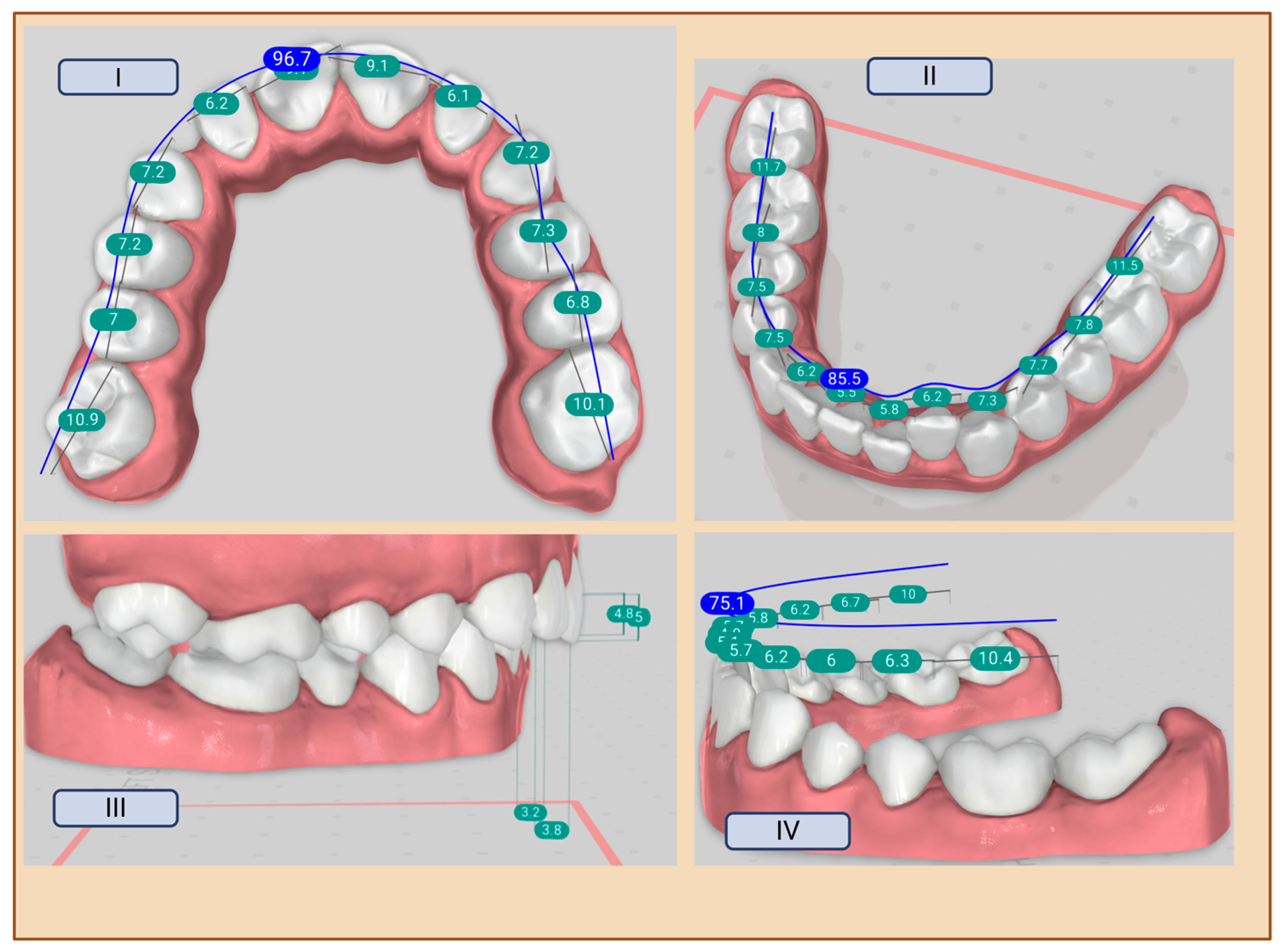 Applsci 15 07786 g003
