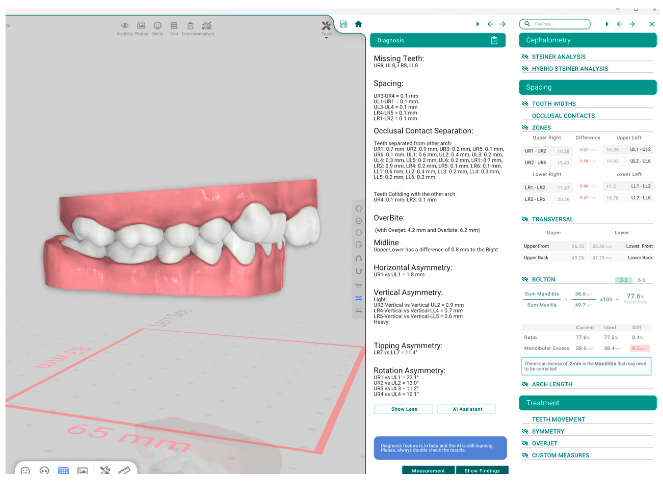Applsci 15 07786 g005