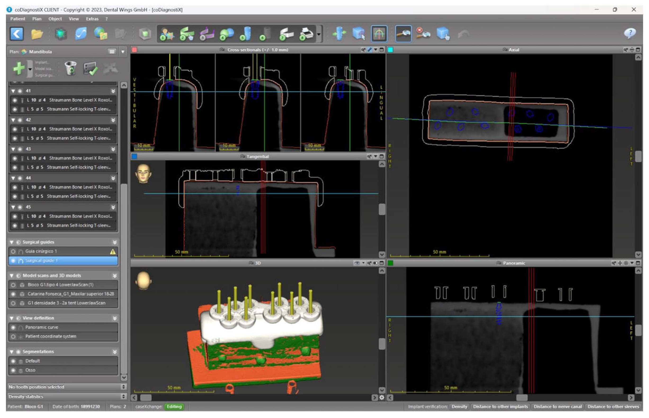 Applsci 15 07826 g003
