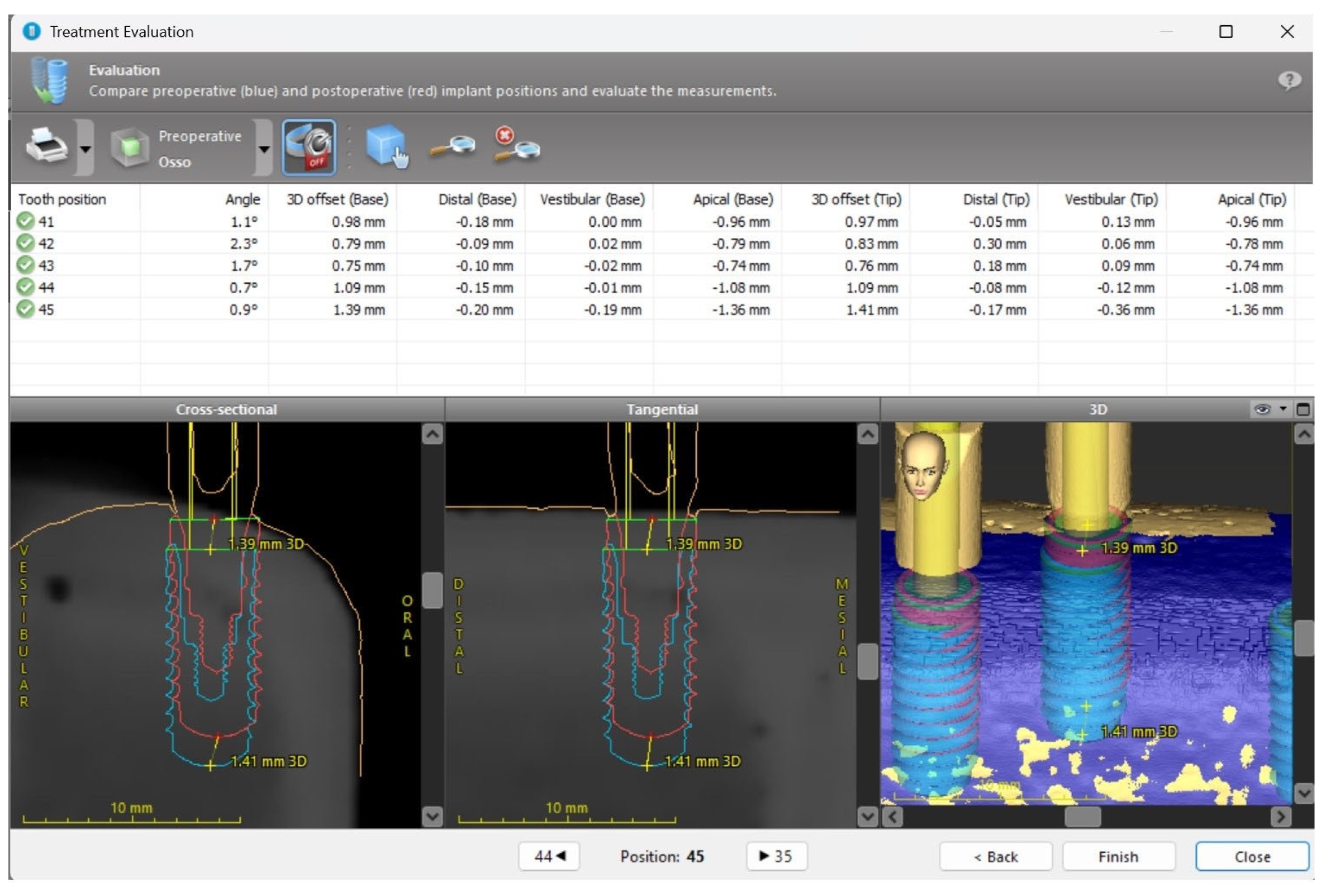 Applsci 15 07826 g005