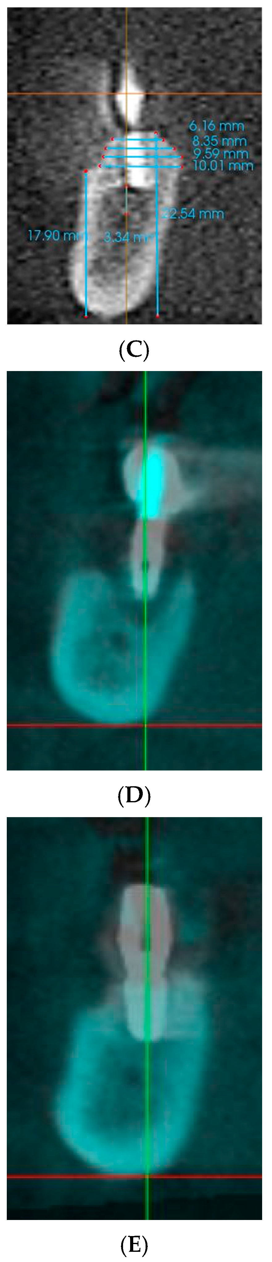 Applsci 15 07934 g002b