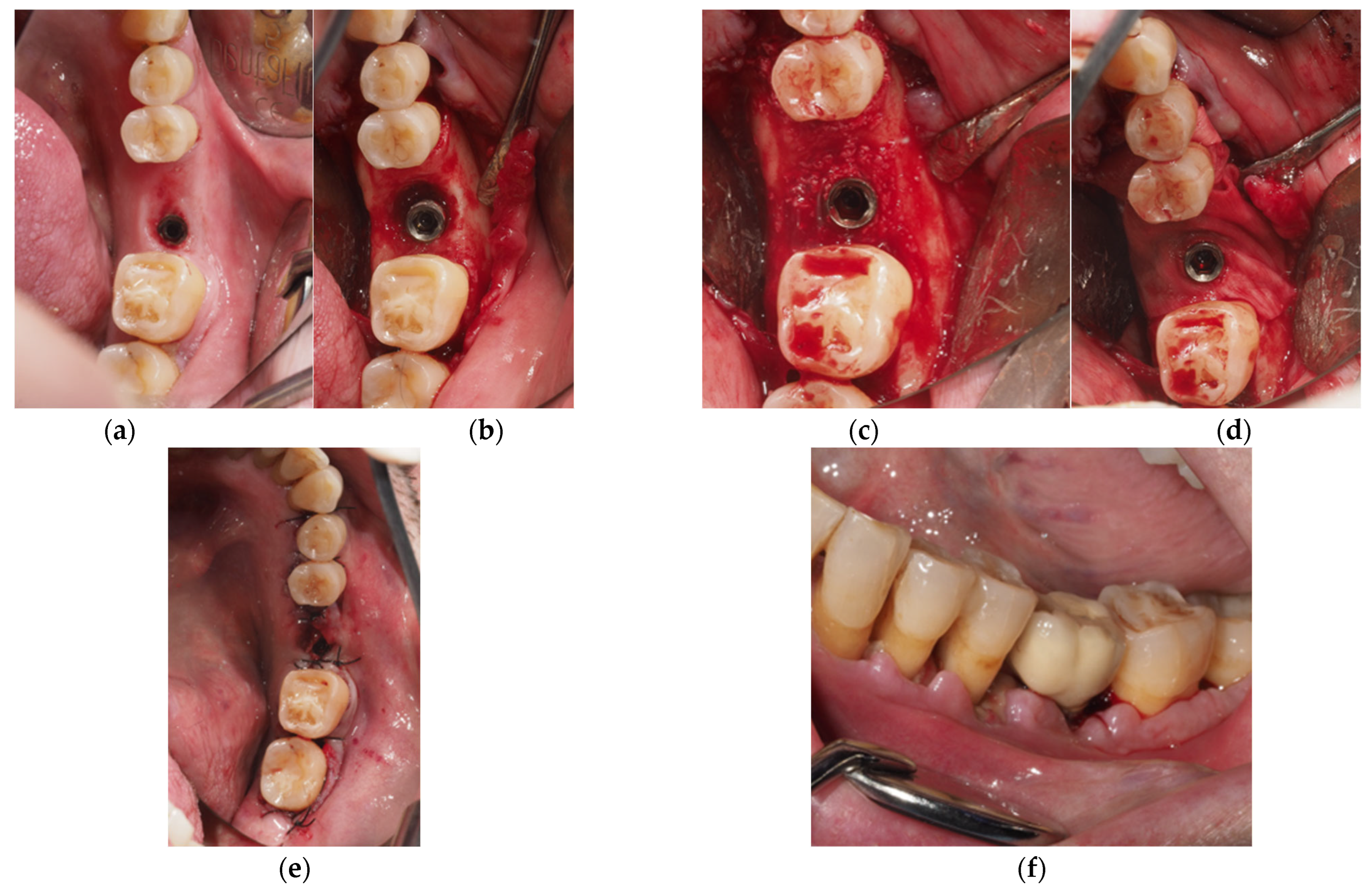 Applsci 15 08040 g001a
