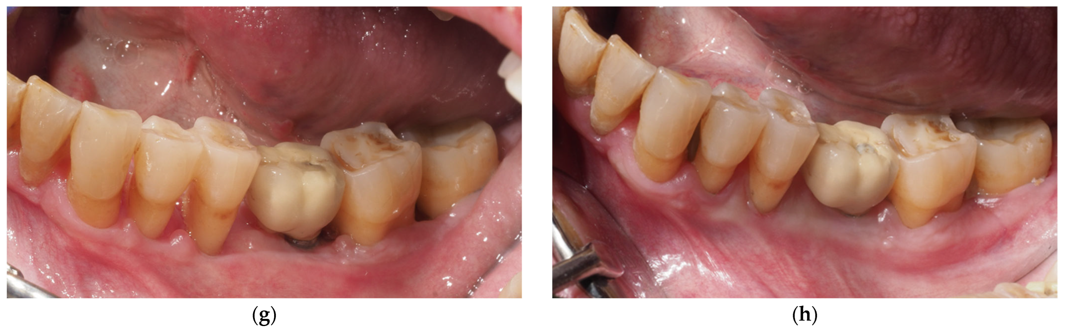 Applsci 15 08040 g001b