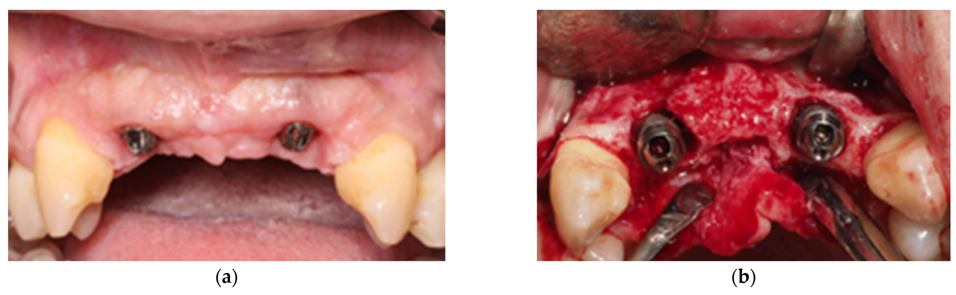 Applsci 15 08040 g002a